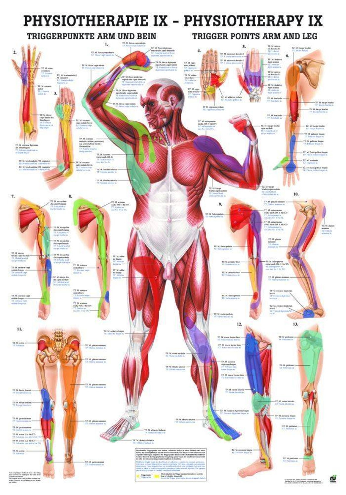 Trigger Points Arms and Legs Laminated Chart