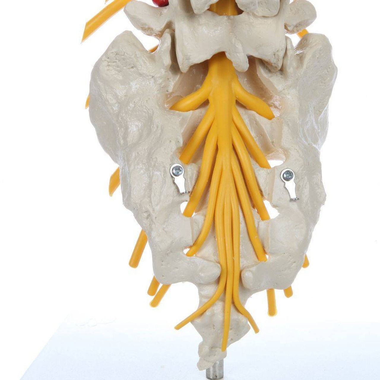 Rudiger Anatomie Premium Lumbar Spine with Herniated Disc