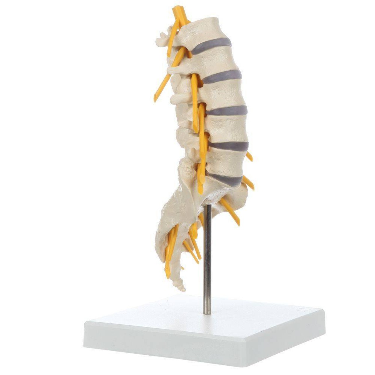 Rudiger Anatomie Premium Lumbar Spine with Herniated Disc