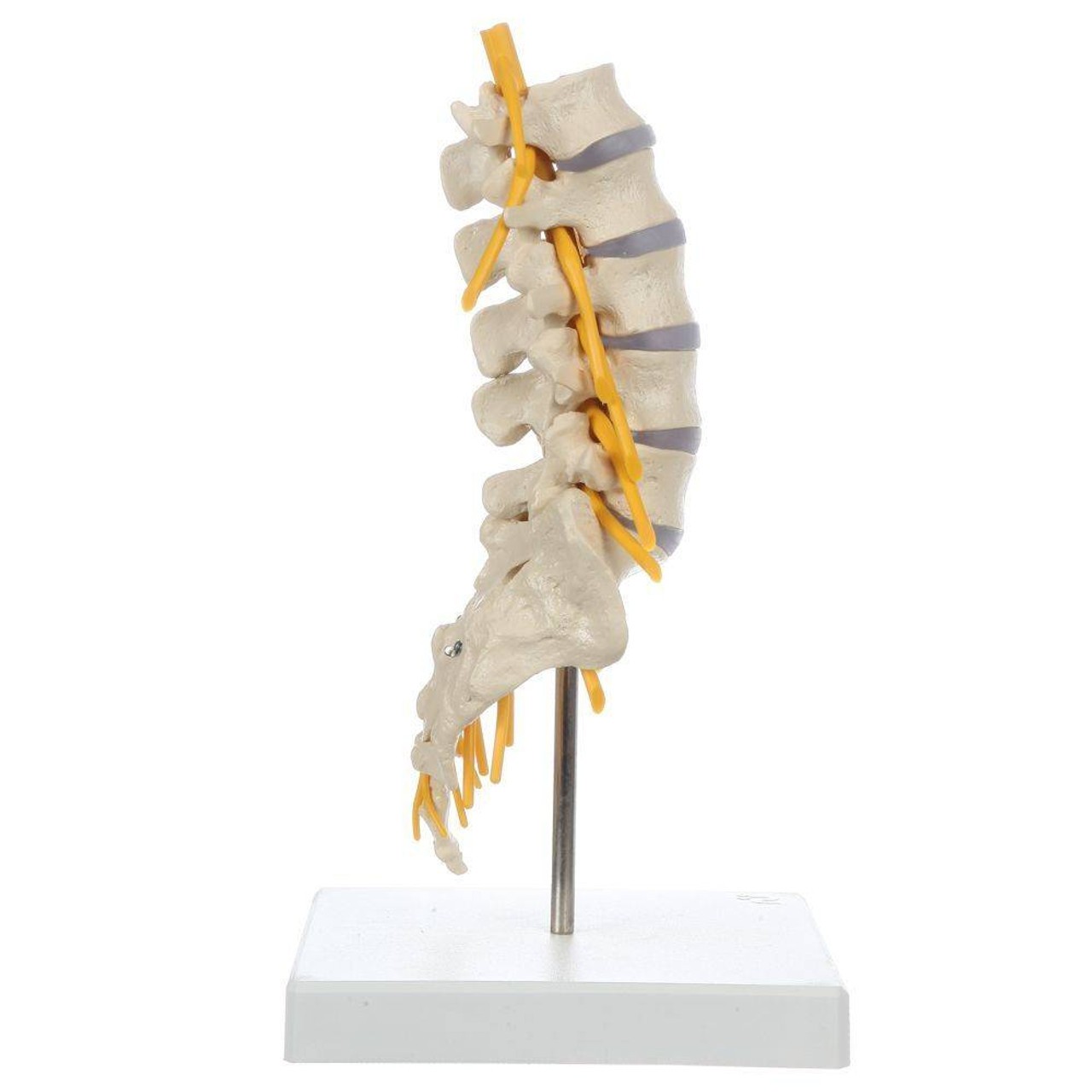 Rudiger Anatomie Premium Lumbar Spine with Herniated Disc