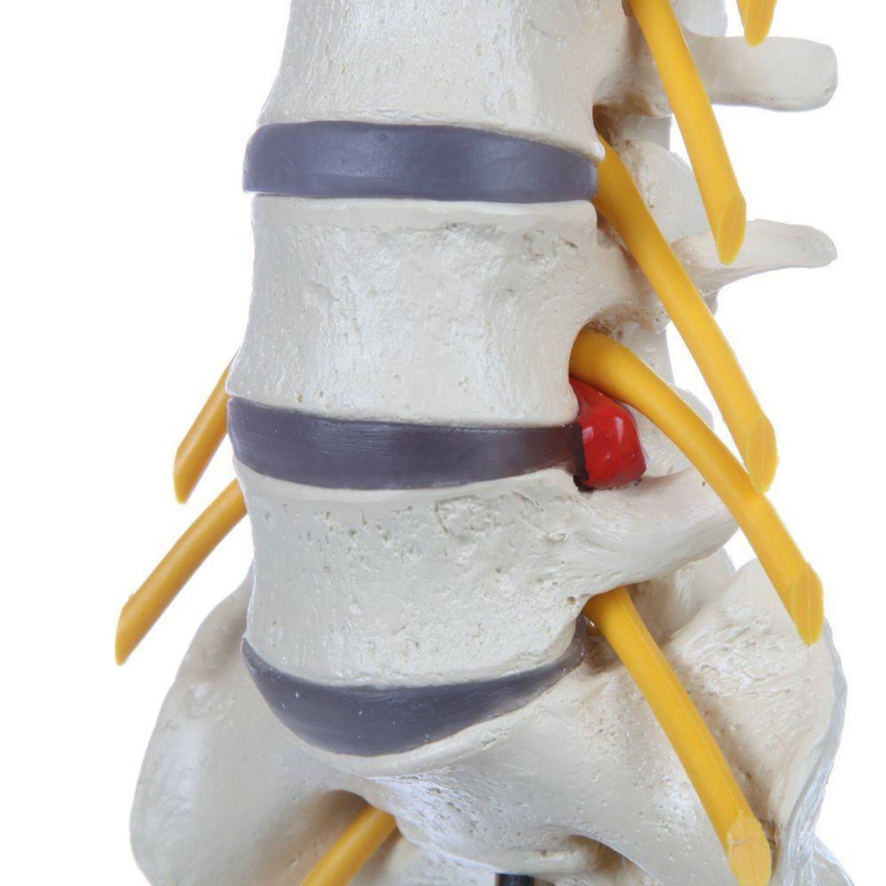 Rudiger Anatomie Premium Lumbar Spine with Herniated Disc