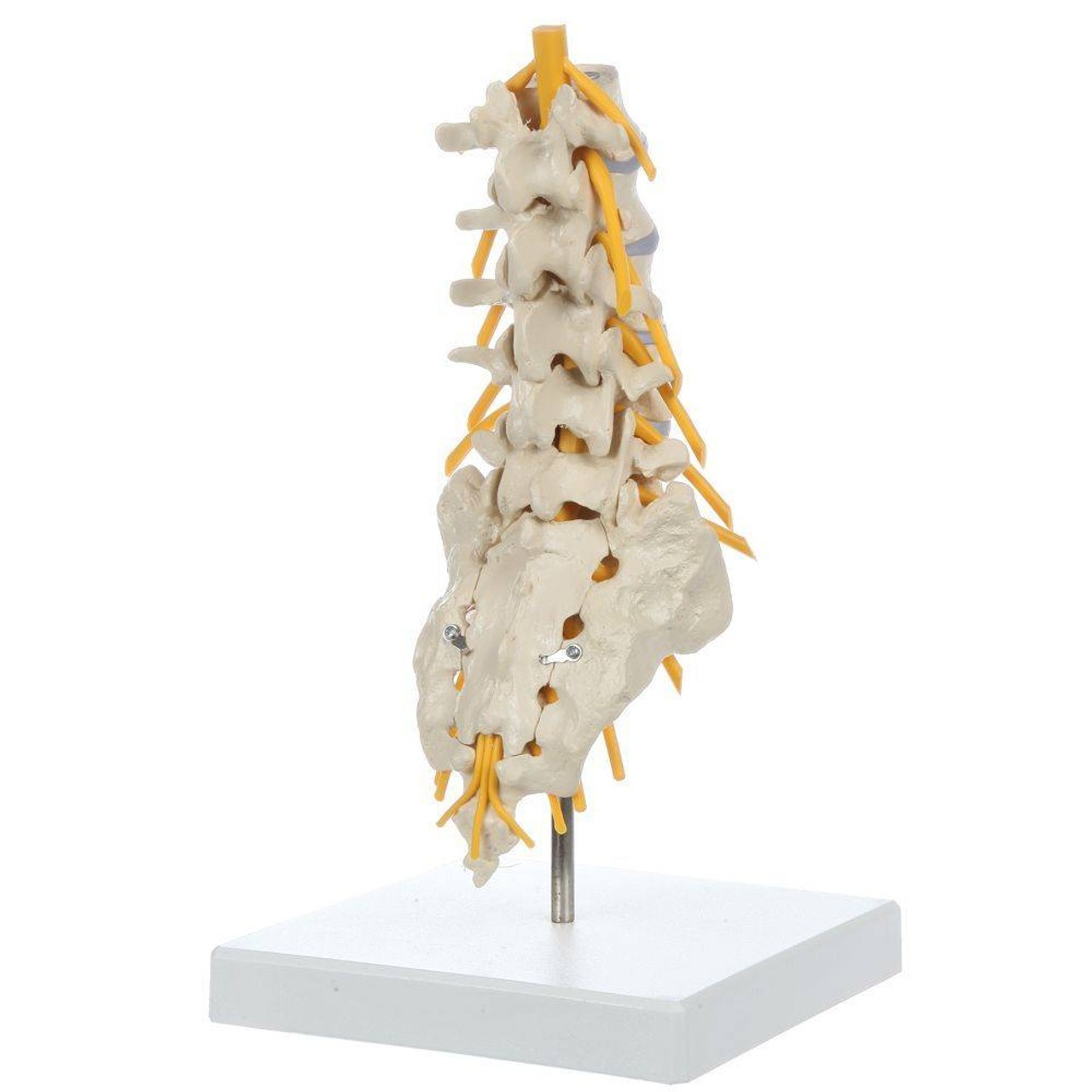 Rudiger Anatomie Premium Lumbar Spine with Herniated Disc