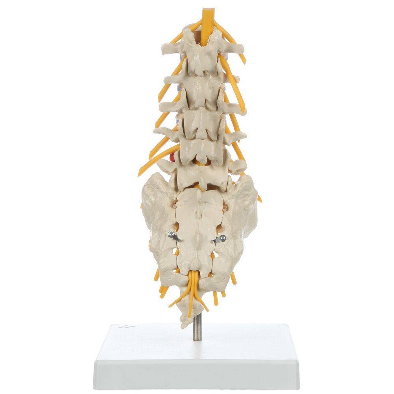 Rudiger Anatomie Premium Lumbar Spine with Herniated Disc