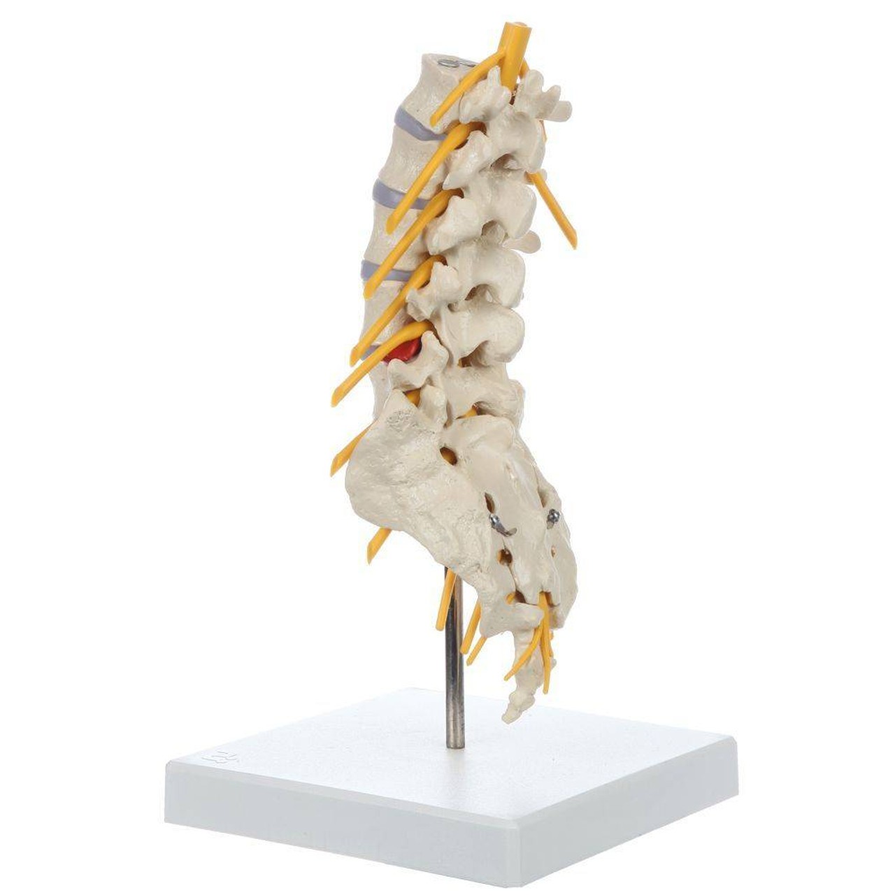 Rudiger Anatomie Premium Lumbar Spine with Herniated Disc