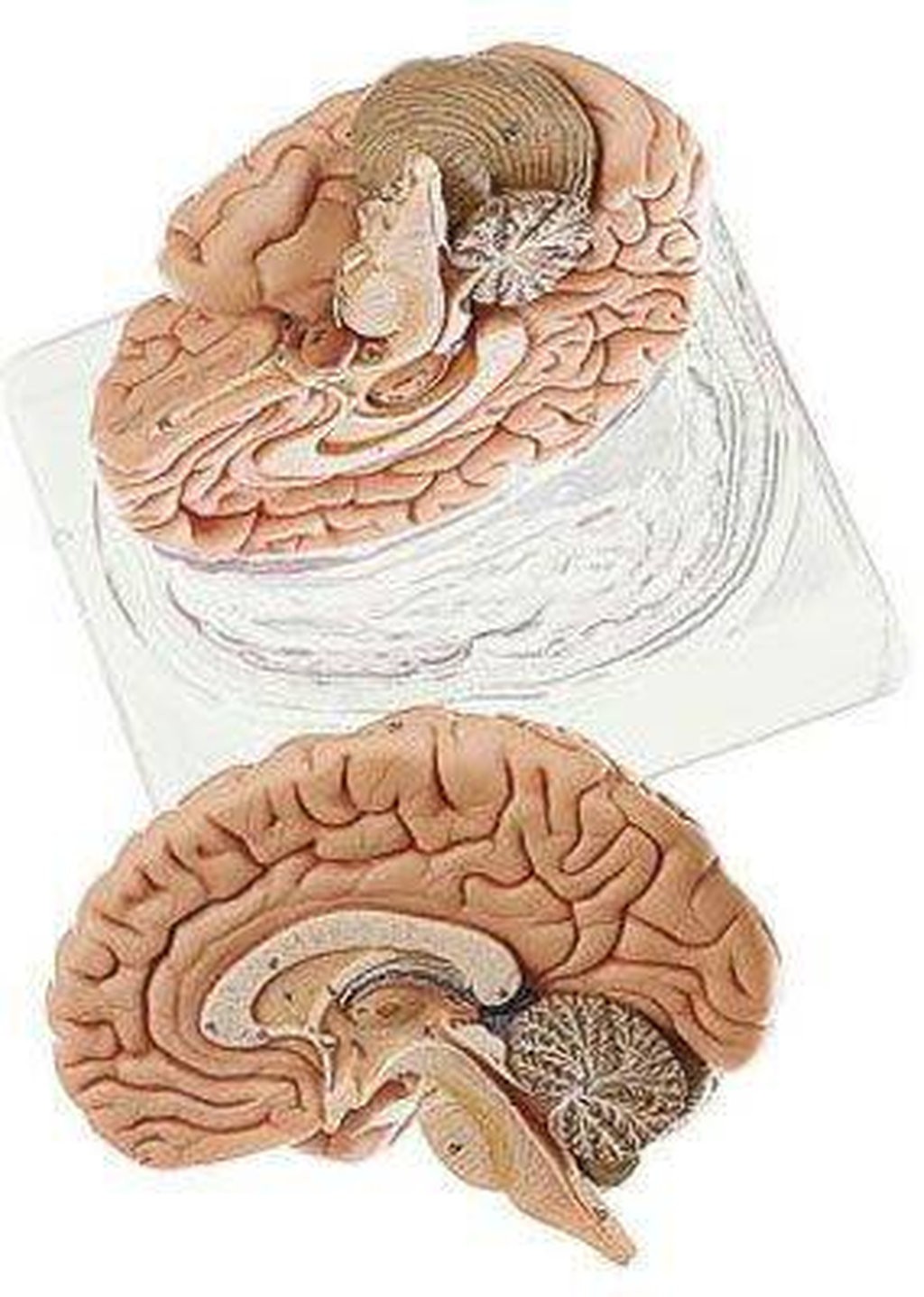 SOMSO Deluxe Brain in 2 Parts