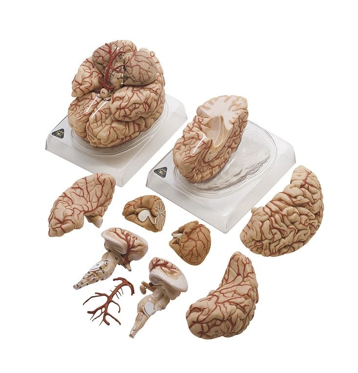 SOMSO Deluxe Brain with Arteries in 9 Parts