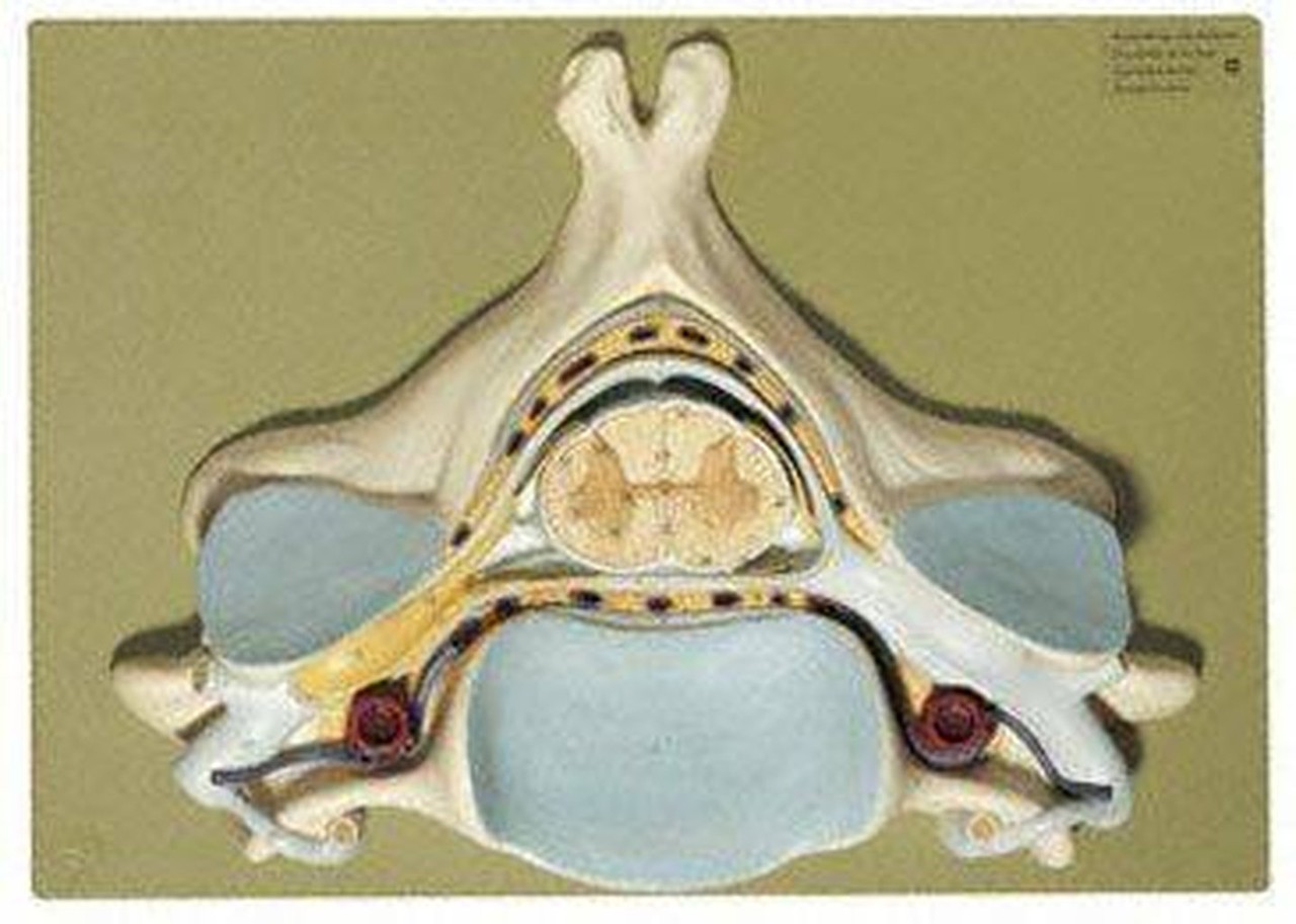 SOMSO Fifth Cervical Vertebra- 7x Life Size