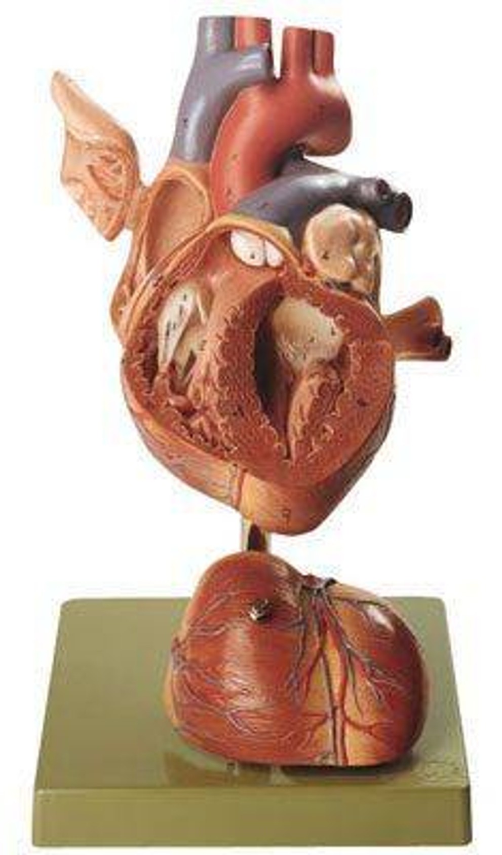 SOMSO Premium Heart in 4 Parts - 2x Life Size | Anatomy