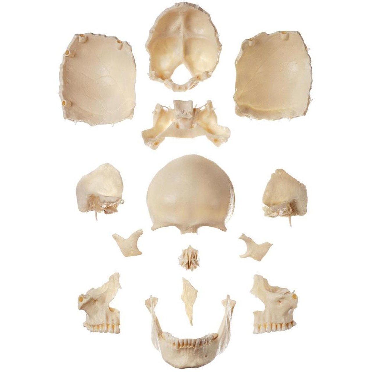 SOMSO Disarticulated Skull in 14 Pieces