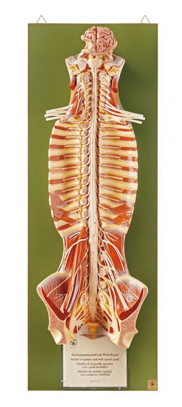 SOMSO Spinal Cord in the Spinal Canal