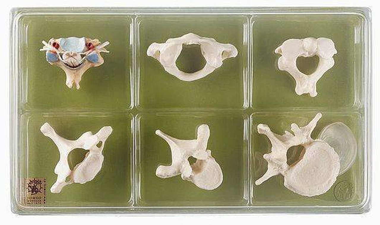 SOMSO Collection of Vertebrae and Spinal Cord
