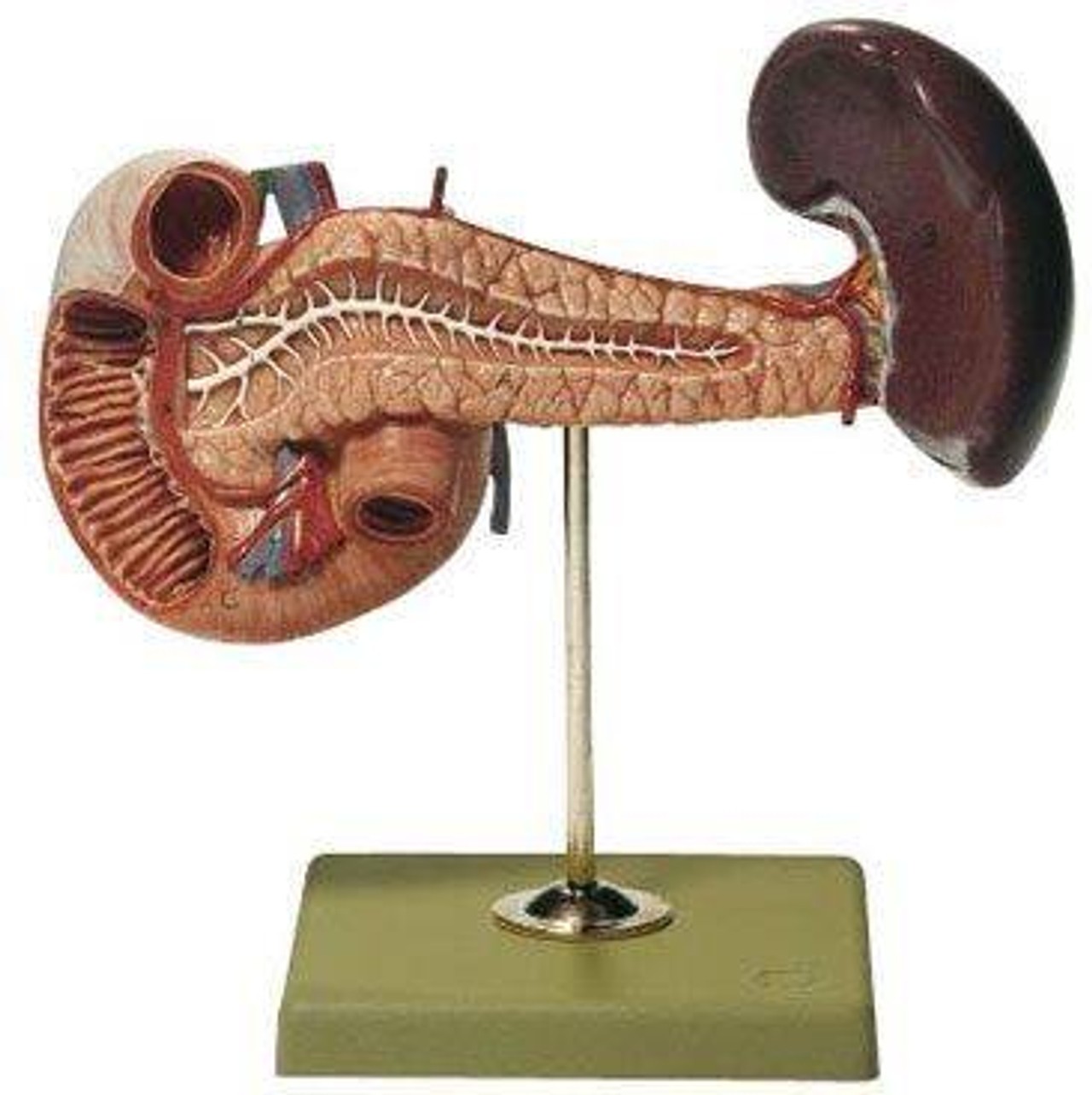 SOMSO Pancreas with Spleen and Duodenum