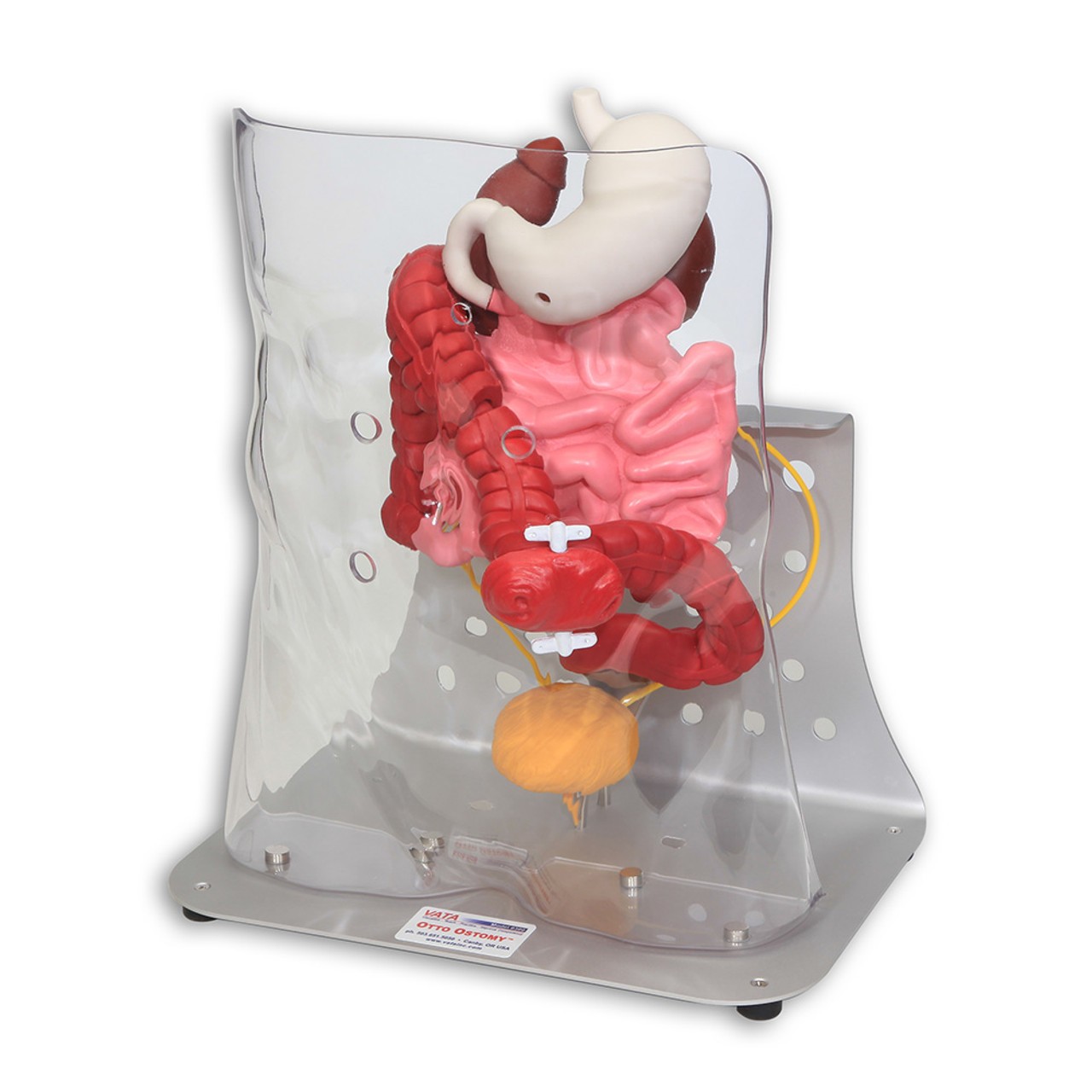 Otto Ostomy - Advanced Model with Case
