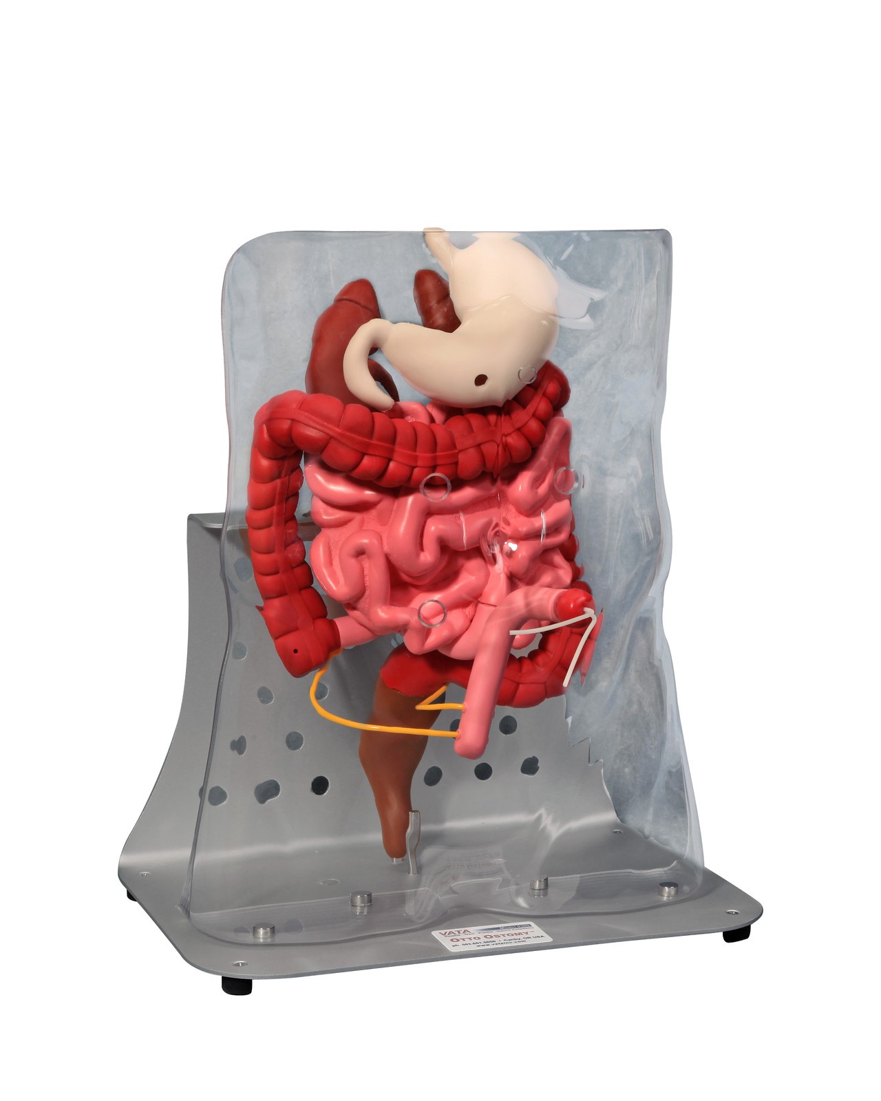 Otto Ostomy - Advanced Model with Case