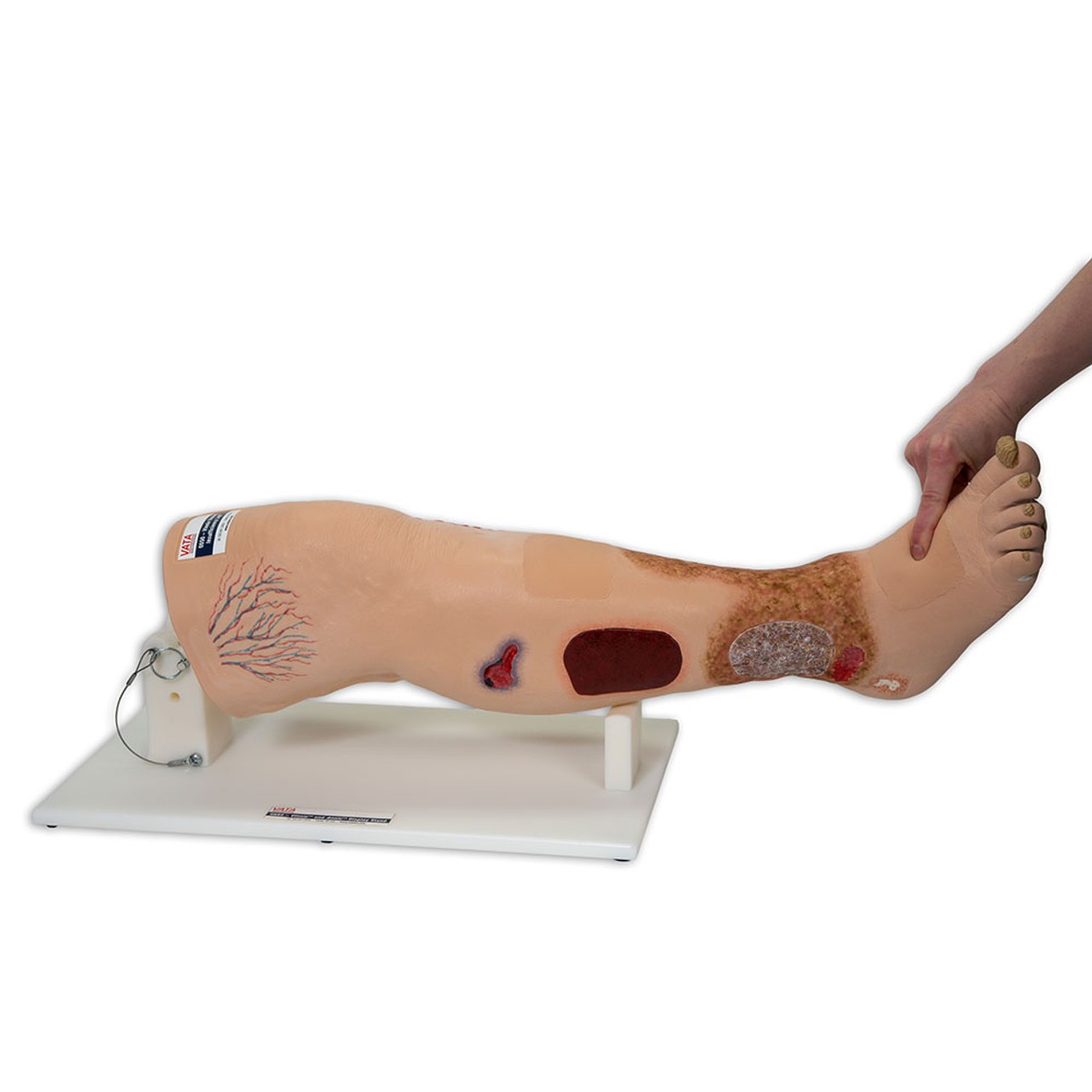 Vinnie Venous Insufficiency Leg Model