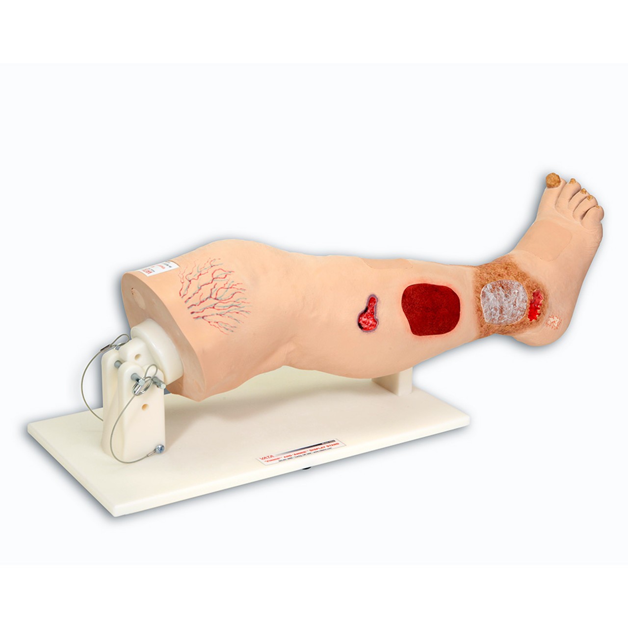 Vinnie Venous Insufficiency Leg Model