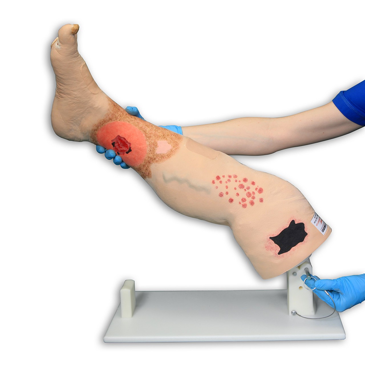 Vinnie Venous Insufficiency Leg Model