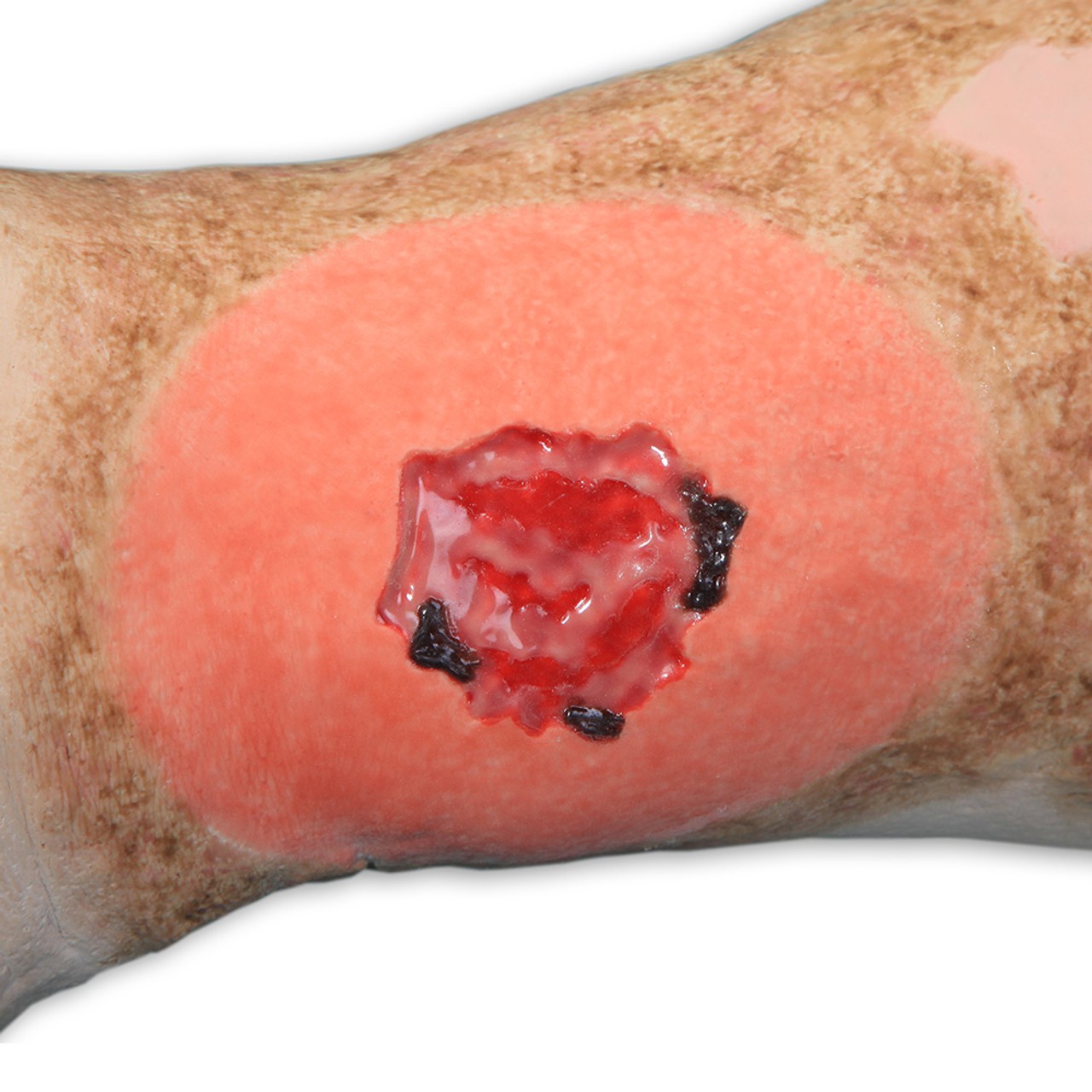 Vinnie Venous Insufficiency Leg Model