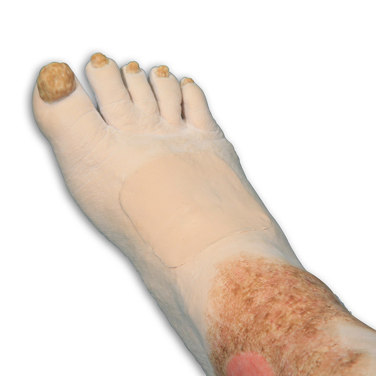 Vinnie Venous Insufficiency Leg Model