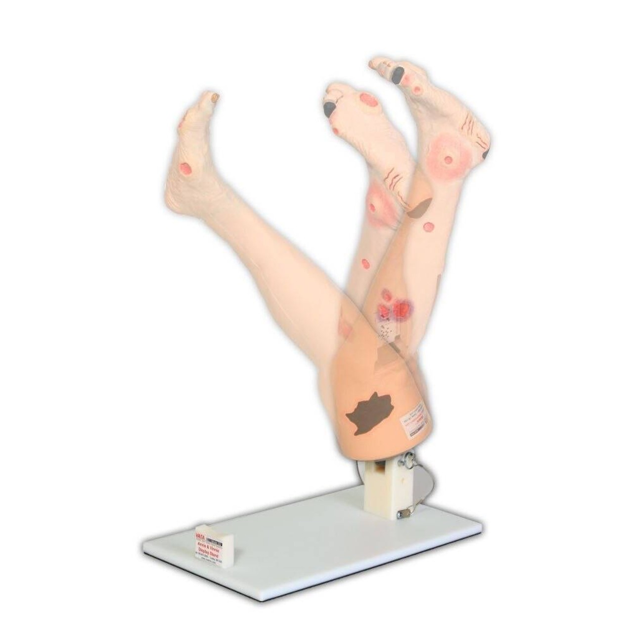 Optional Display Stand For Vinnie Or Annie Insufficiency Leg Models