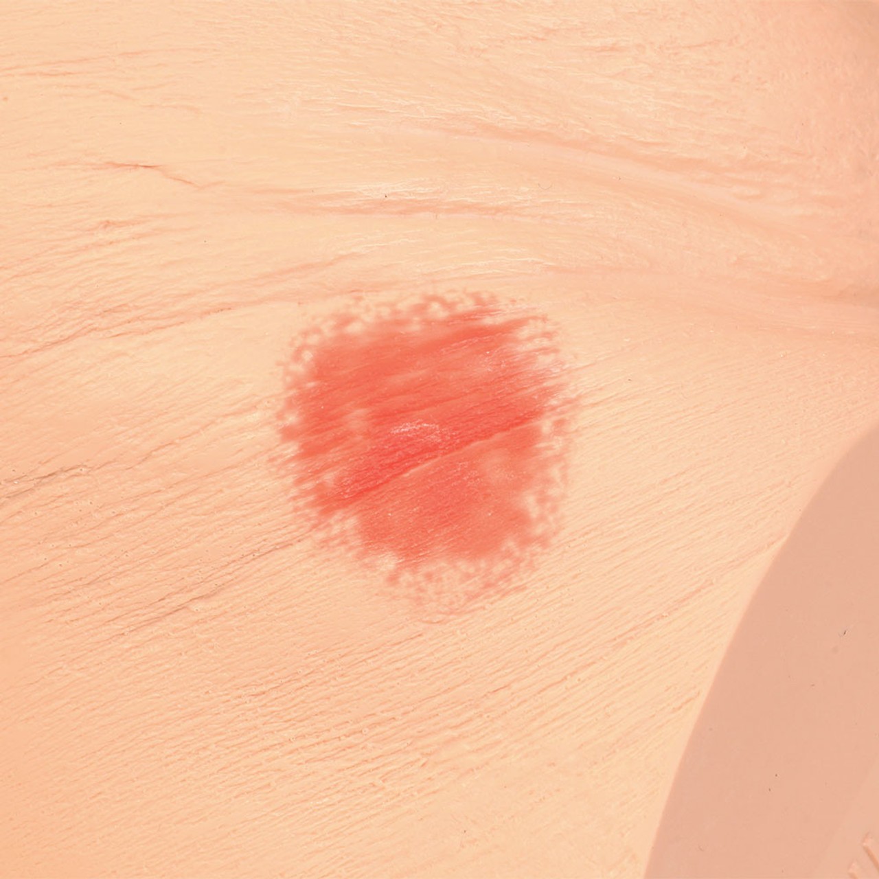 Seymour II Wound Care Model