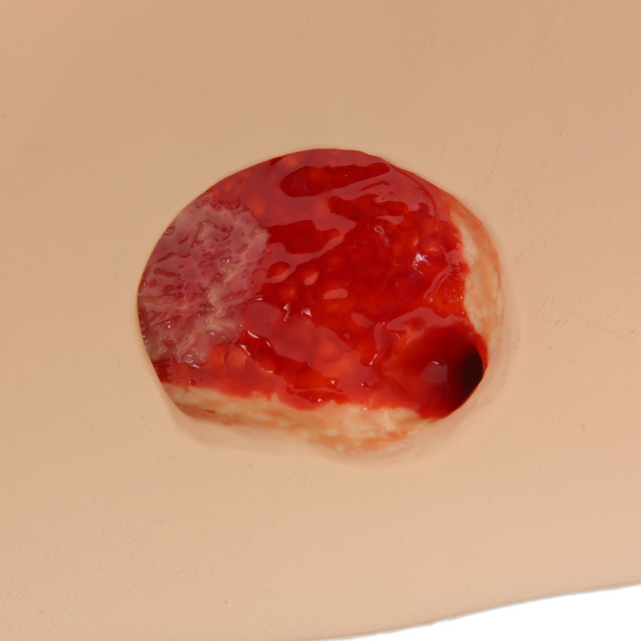 Seymour II Wound Care Model
