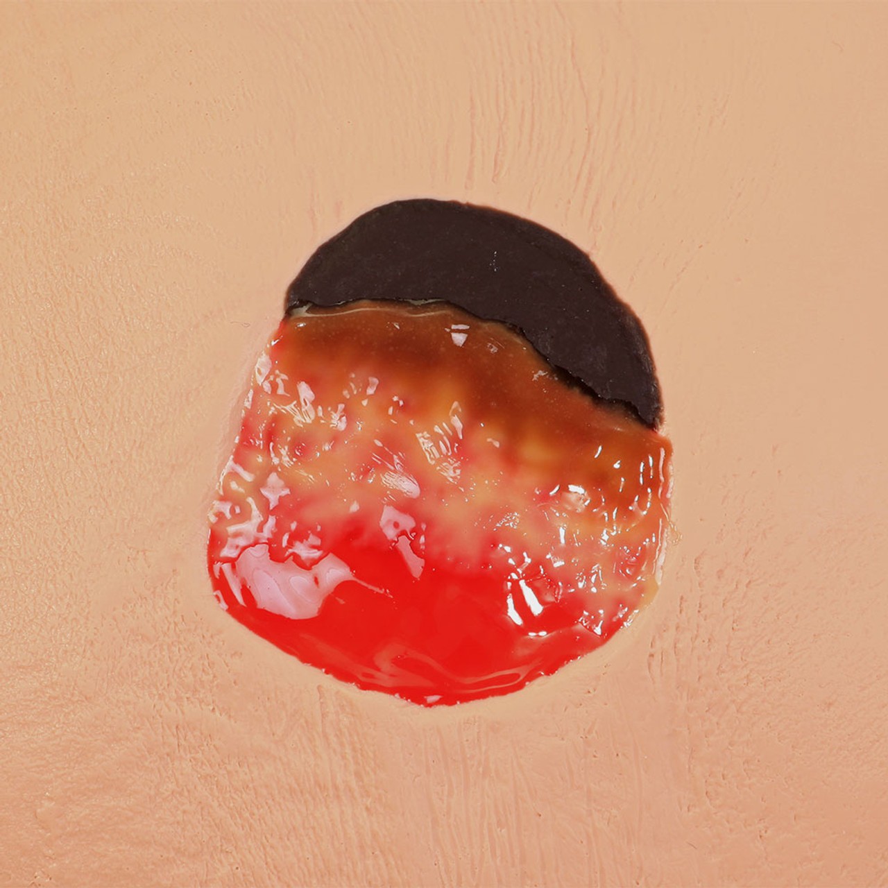 Seymour II Wound Care Model