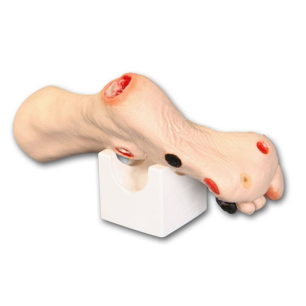 Wilma Wound Foot