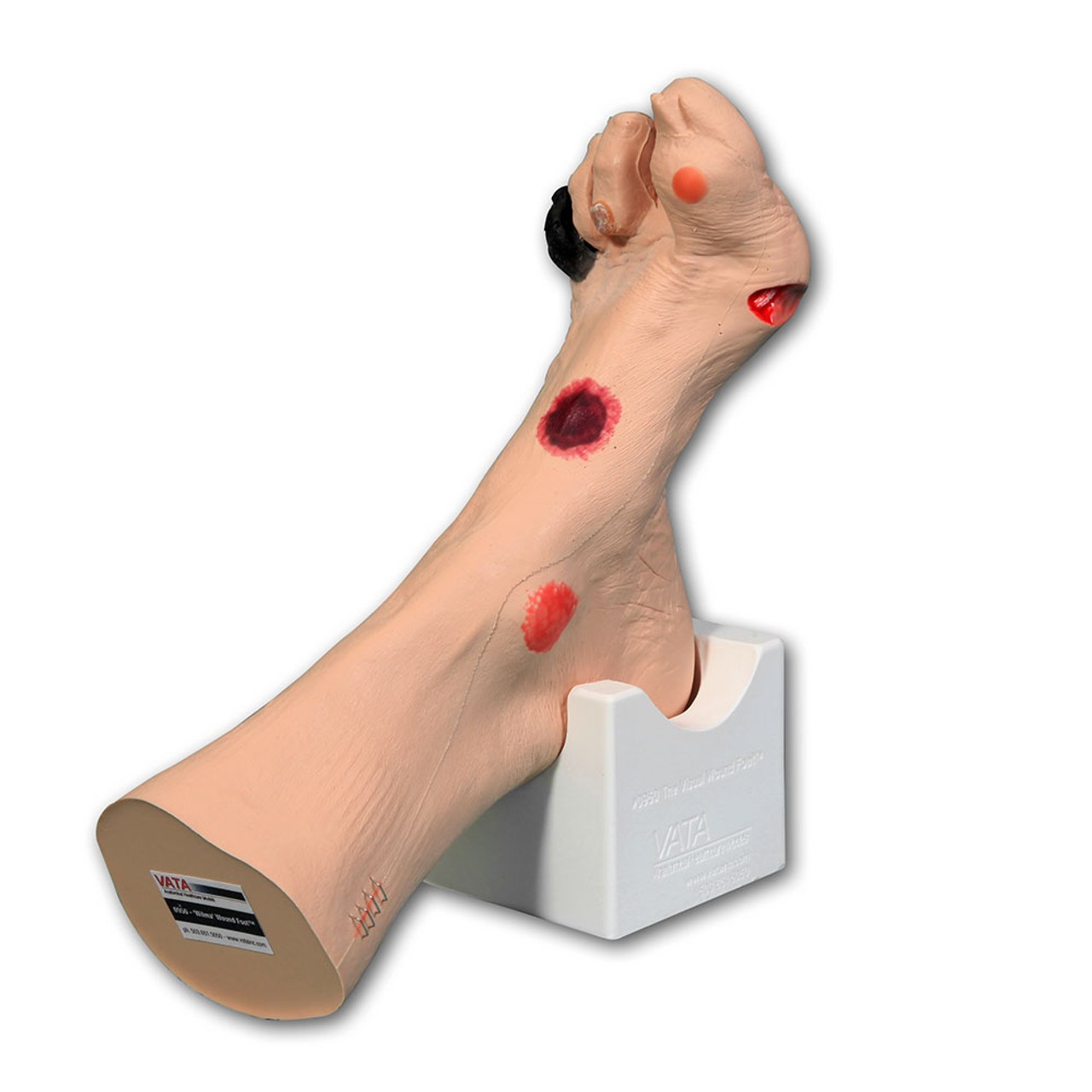 Wilma Wound Foot