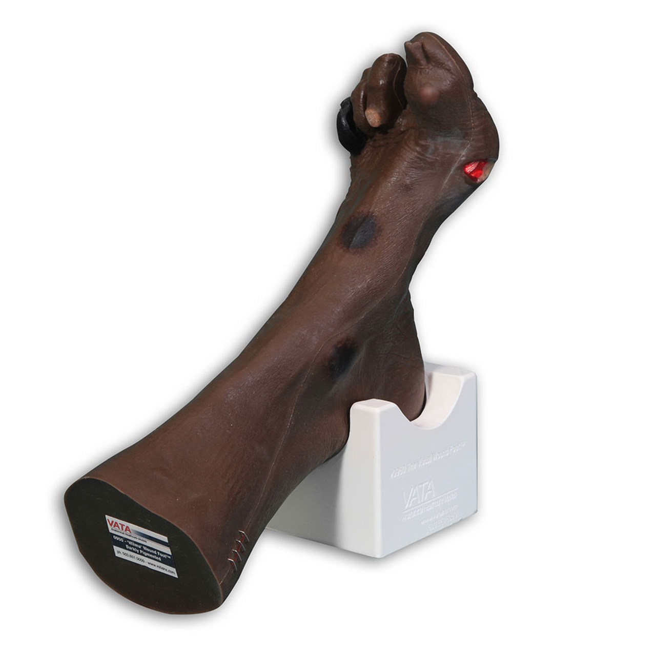 Wilma Wound Foot, Darkly Pigmented