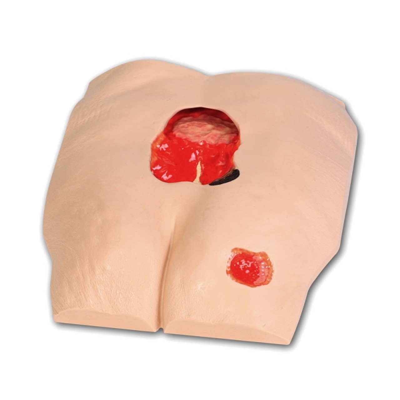 Stan Stage 4 Pressure Injury Model, Lightly Pigmented