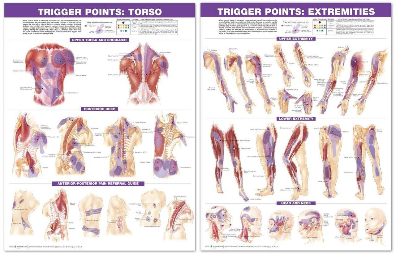 Trigger Point Chart Set Torso and Extremities - 2nd Edition - Laminated