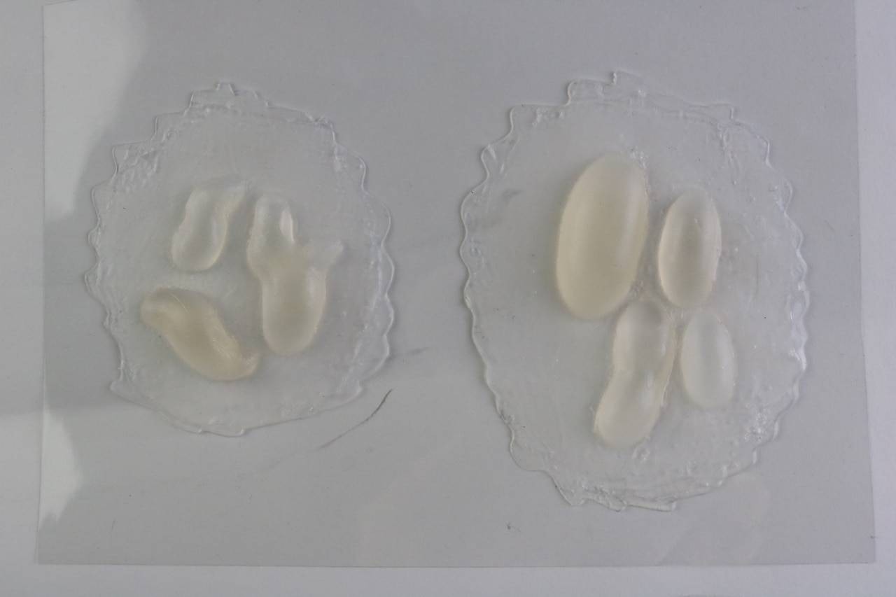 Anatomy Lab Moulage - 2 Piece Set of Burn and Boil Blisters