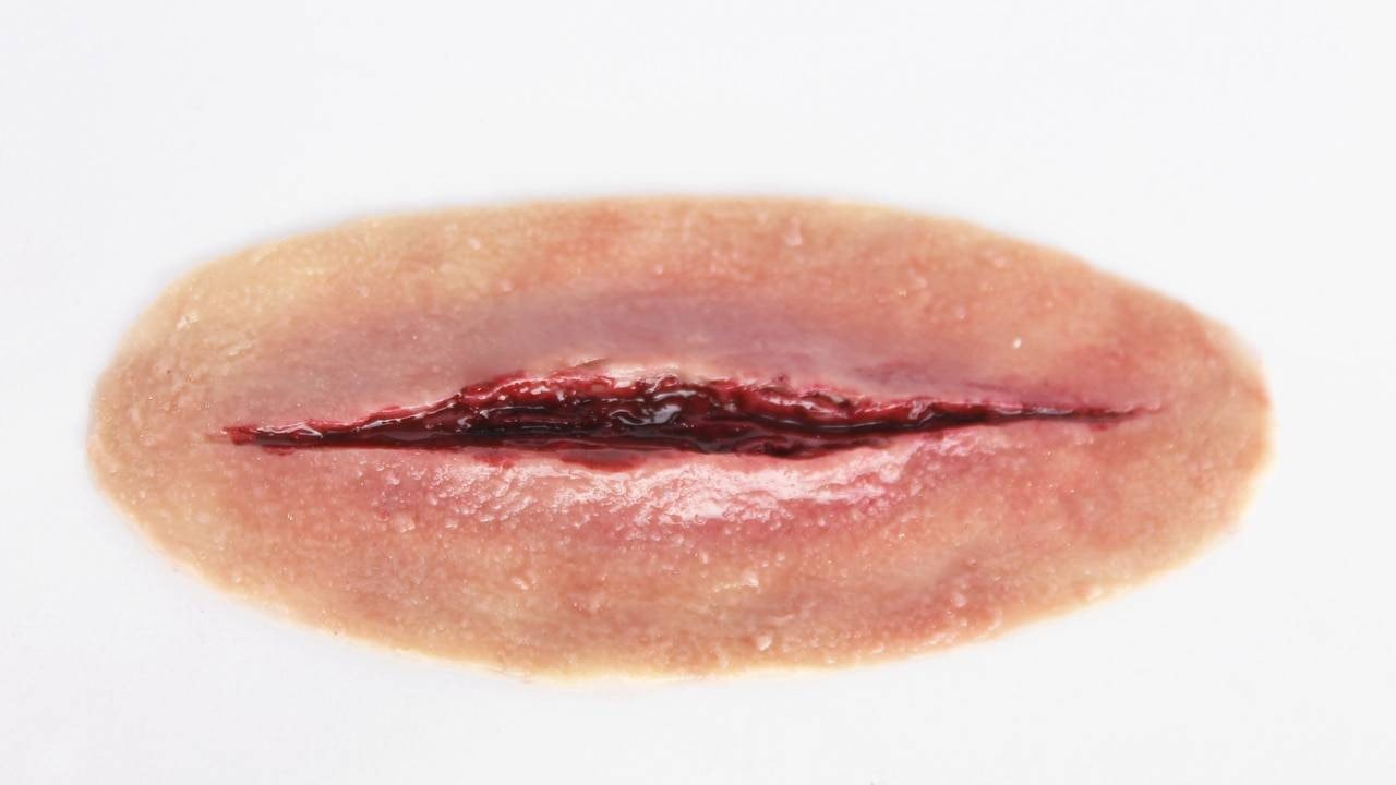 Anatomy Lab Moulage - 5 Piece Set of Lacerations
