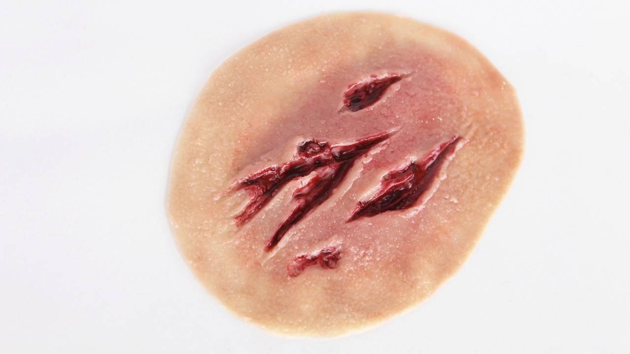 Anatomy Lab Moulage - 5 Piece Set of Lacerations