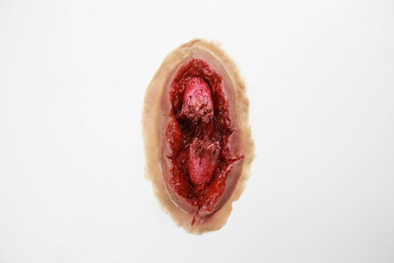 Anatomy Lab Moulage - Hemorrhaging Compound Fracture