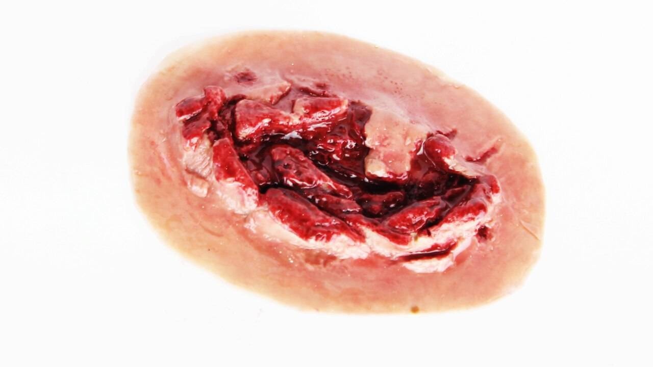 Anatomy Lab Moulage - Hemorrhaging Large Laceration