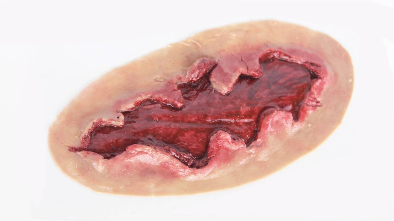 Anatomy Lab Moulage - Exposed Muscle