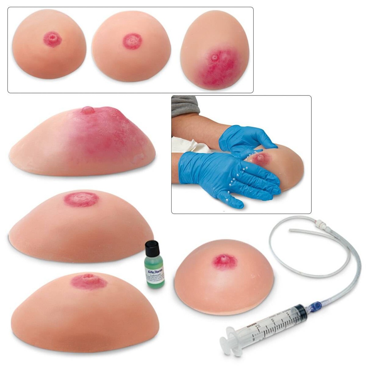 Life/form Common Breast Conditions Replicas - Set of 4