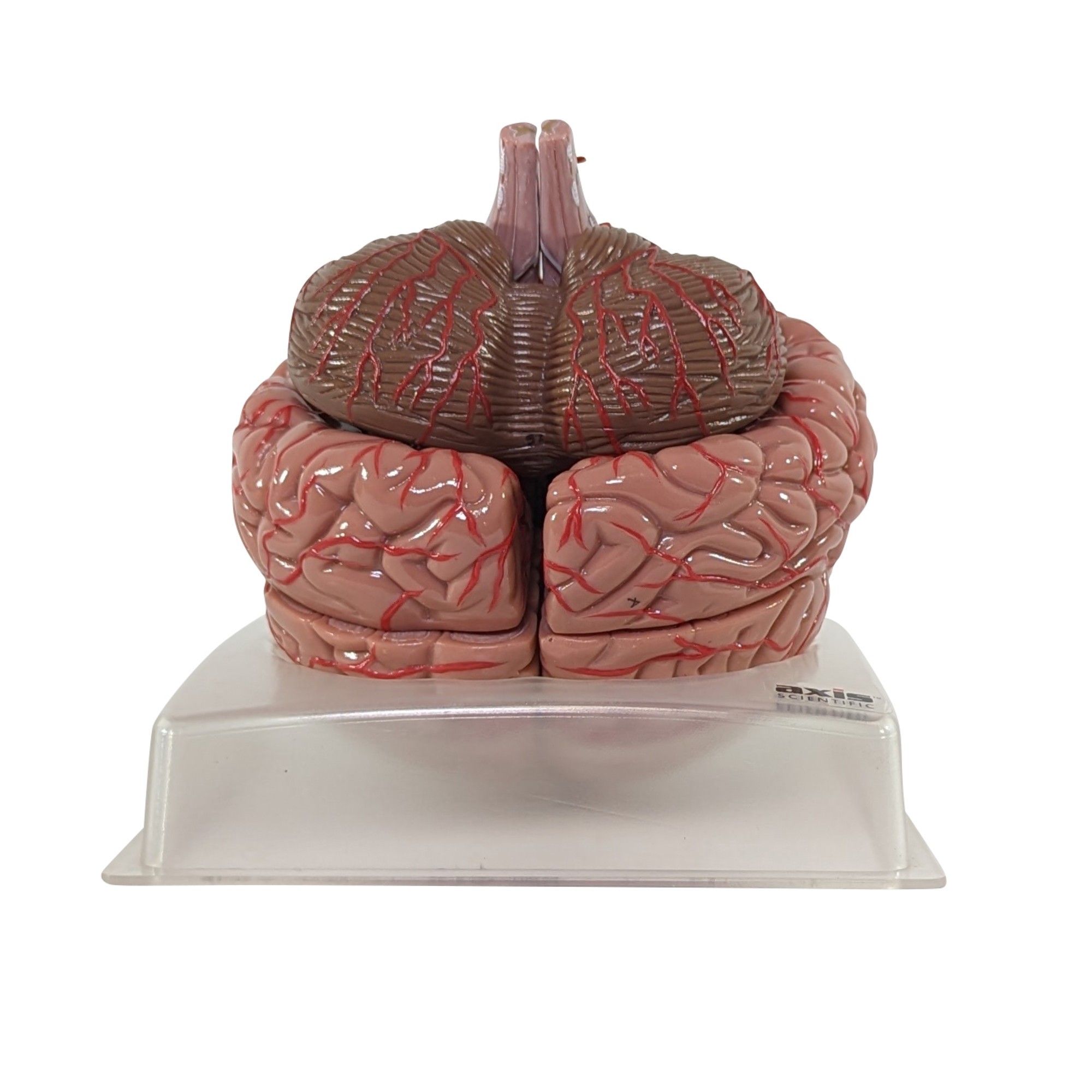 3B Scientific Half Human Head with Deluxe Brain with Arteries Anatomy ...