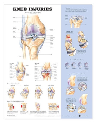 Anatomy And Injuries Of The Knee Poster - Knee Joint Chart In At And Injuries Of The Knee Poster Knee Joint Anatomical Chart 18 X 27