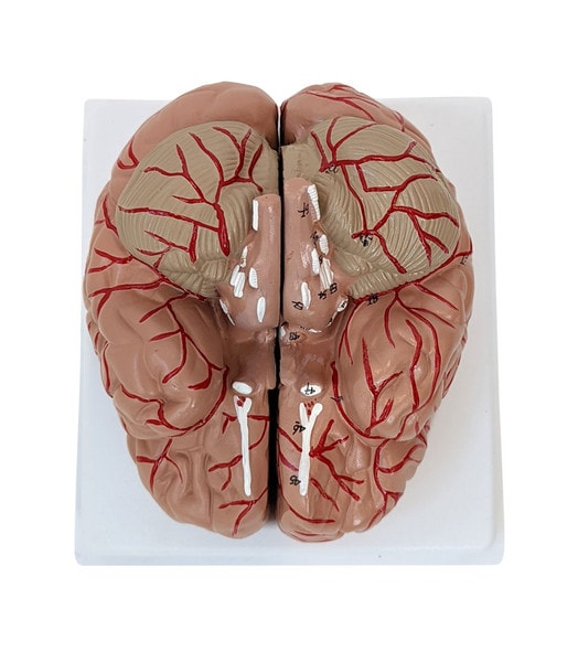 Anatomy Lab Basic 2 Part Brain Model with Arteries and Blood Vessels Anatomy Lab Basic 2 Part Brain Model with Arteries and Blood Vessels