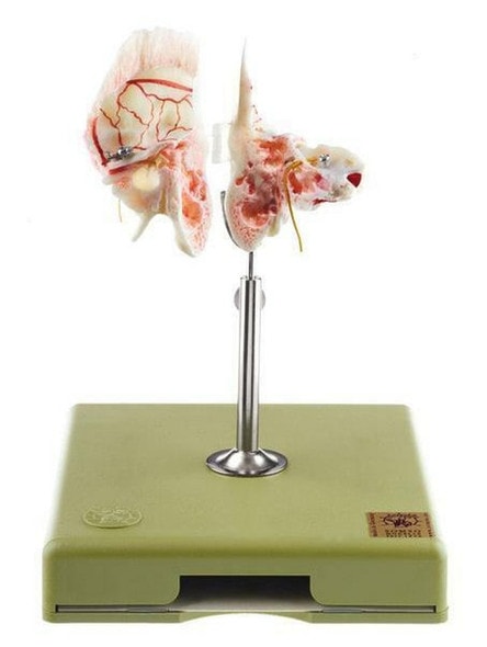 SOMSO Artificial Temporal Bone Anatomy Model