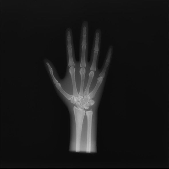 Anthropomorphic Hand Phantom Anthropomorphic Hand Phantom