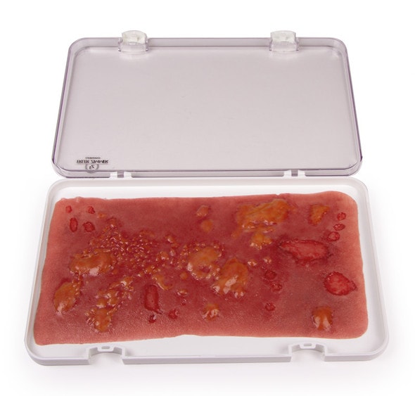Skin Moulage, Large 2nd Degree Burn Wound Skin Moulage, Large 2nd Degree Burn Wound