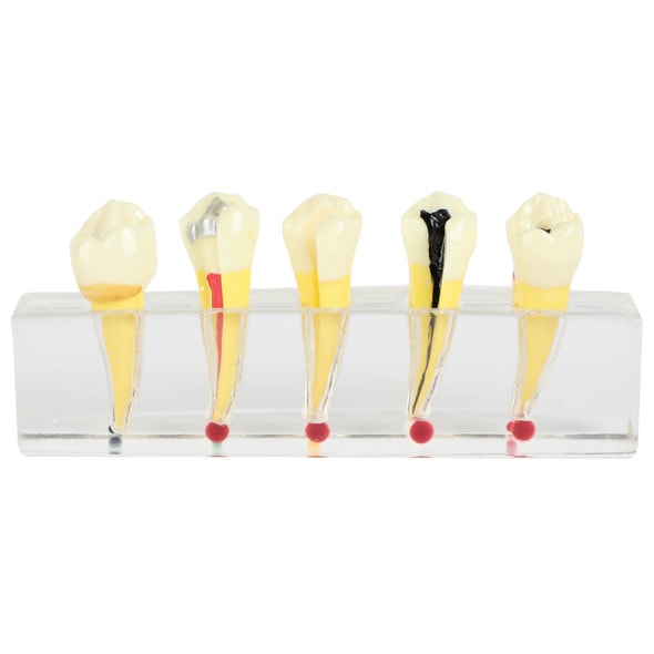 Axis Scientific Dental Pulp Repair Anatomy Model Front View with Mouth Closed Axis Scientific Dental Pulp Repair Anatomy Model Front View with Mouth Closed