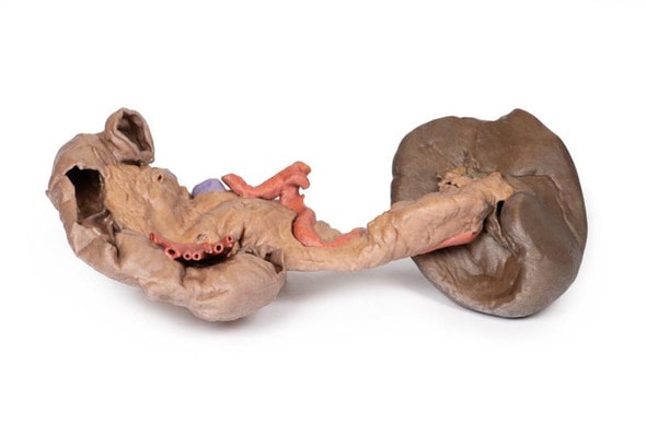 3D Printed Spleen and Pancreas 3D Printed Spleen and Pancreas