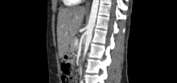 Abdomen Phantom for CT, X-Ray and Radiation Therapy Abdomen Phantom for CT, X-Ray and Radiation Therapy