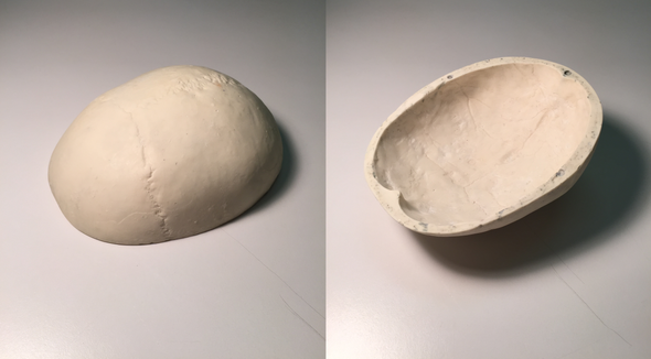 Standard Calvaria for X-Ray CT, US, MRI