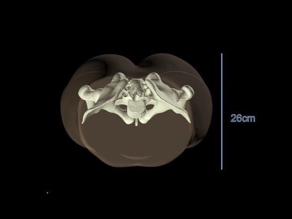 Adult Pelvis for X-Ray CT, US, MRI